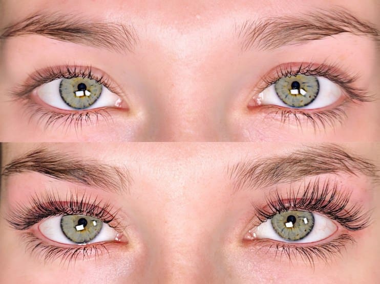 Eyelash-Lift Before-And-After Treatment result | Baltimore, MD | Green Relief Health, LLC