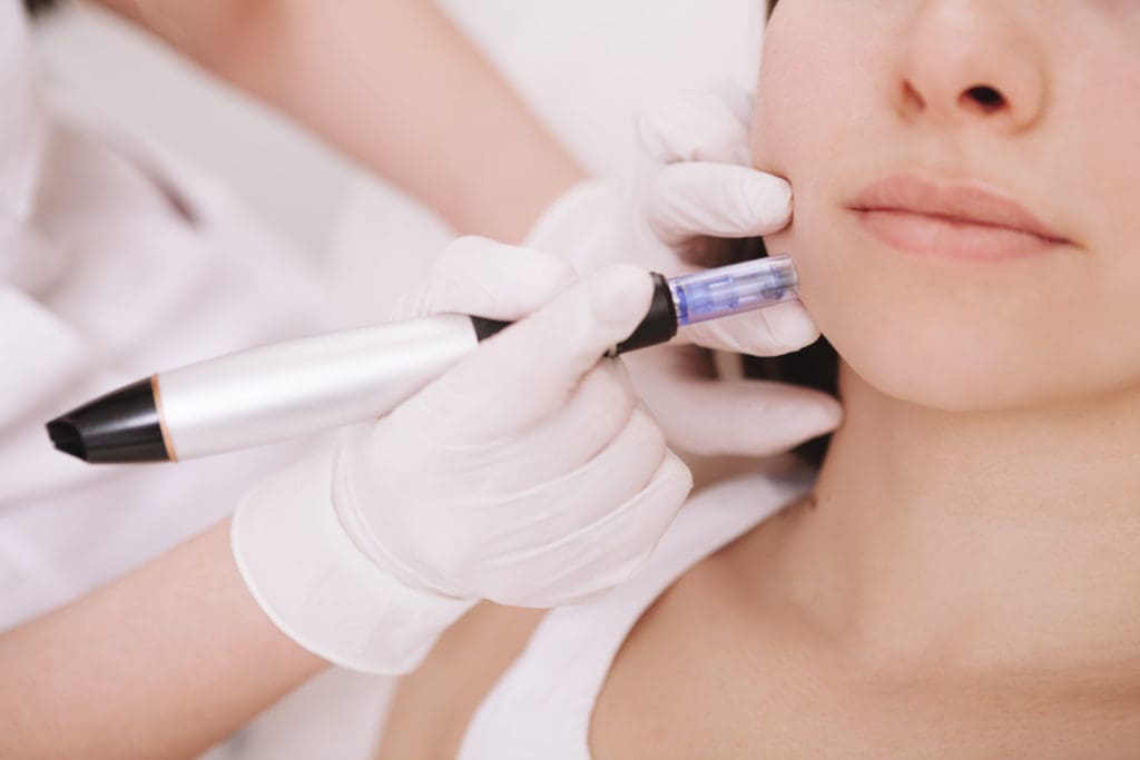 What Is Microneedling Treatment in Baltimore, MD | Green Relief Health, LLC