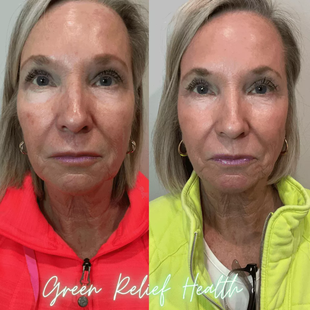 Green Relief Health 1