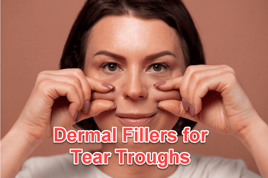 Dermal Fillers for Tear Troughs