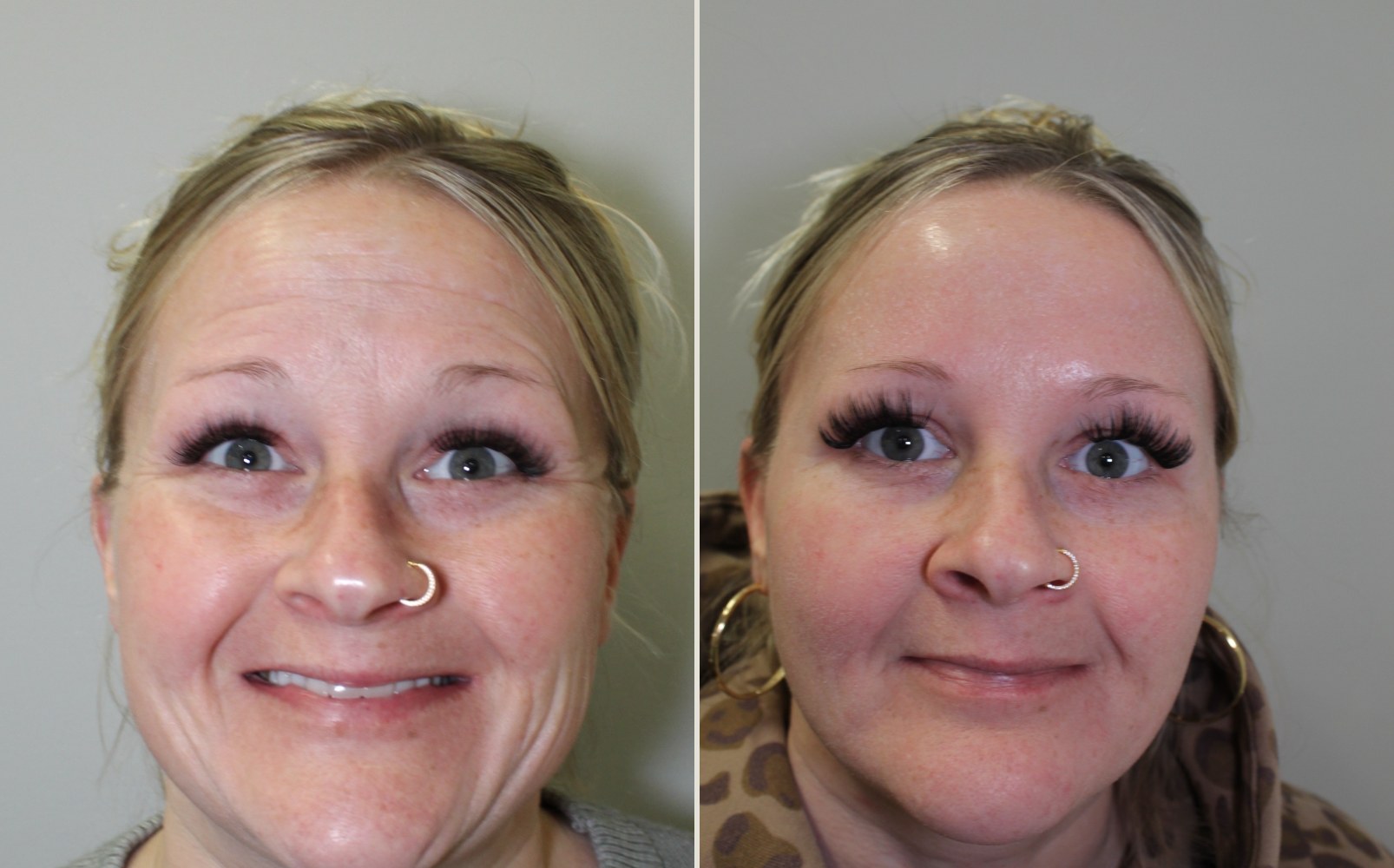Before and after a treatment at Green Relief Health
