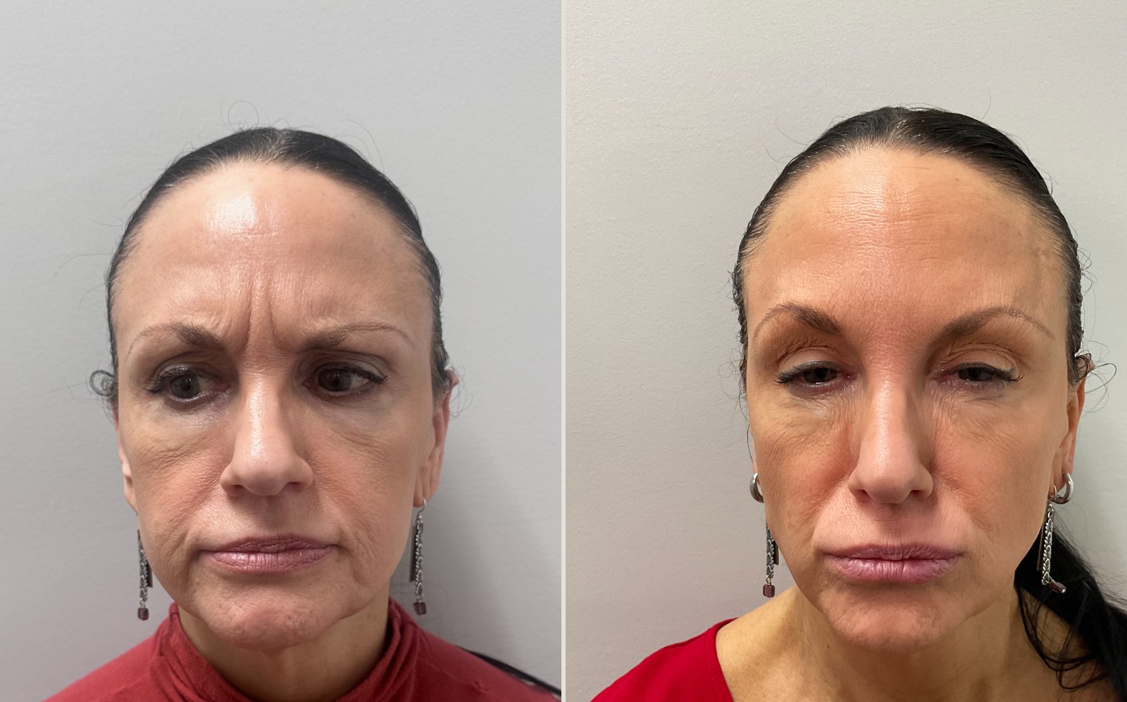 Before and after a treatment at Green Relief Health