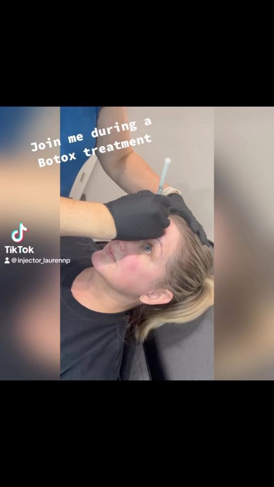 Join us during a Botox appointment